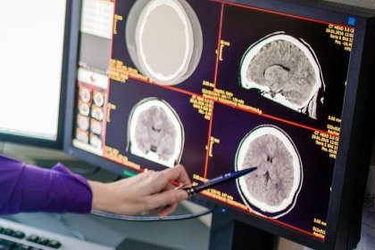 Neuroradiologie | Röntgenpraxis im Tesdorpfhaus