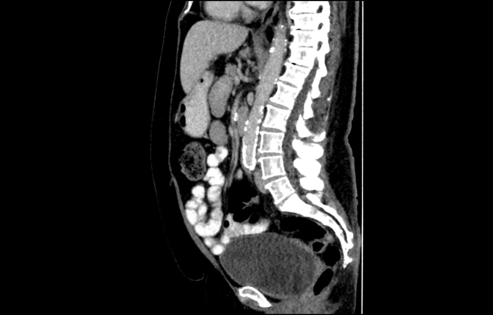 CT Abdomen / Gefäße | Röntgenpraxis im Tesdorpfhaus