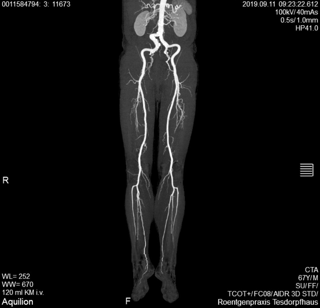 CT Bein / Gefäße | Röntgenpraxis im Tesdorpfhaus