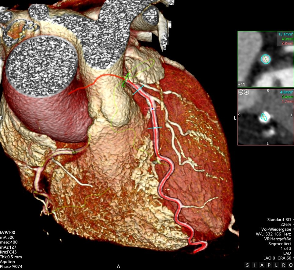 CT Herz | Röntgenpraxis im Tesdorpfhaus