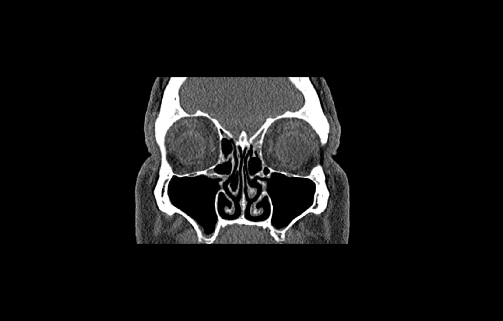 CT Bierenstein / NNH | Röntgenpraxis im Tesdorpfhaus