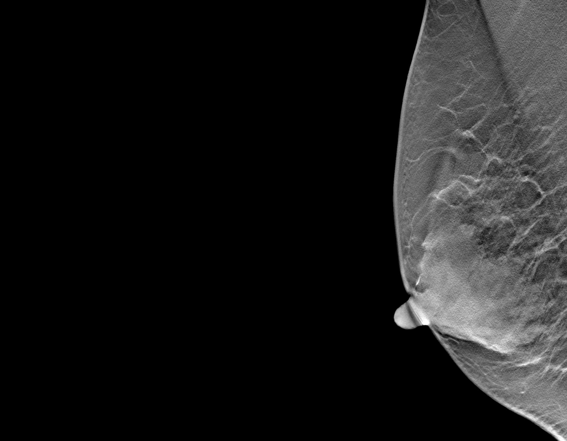 Mammographie / MRT / Tomosynthese | Röntgenpraxis im Tesdorpfhaus