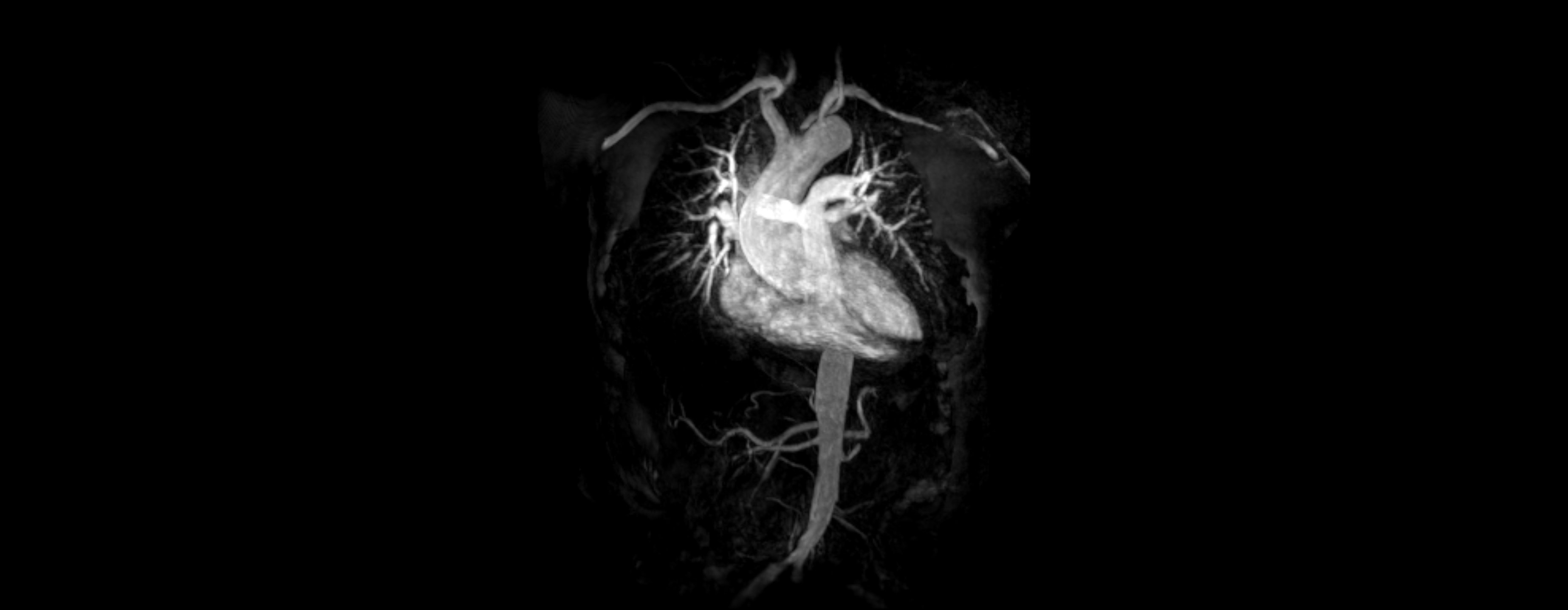 MR Angiographie | Röntgenpraxis im Tesdorpfhaus