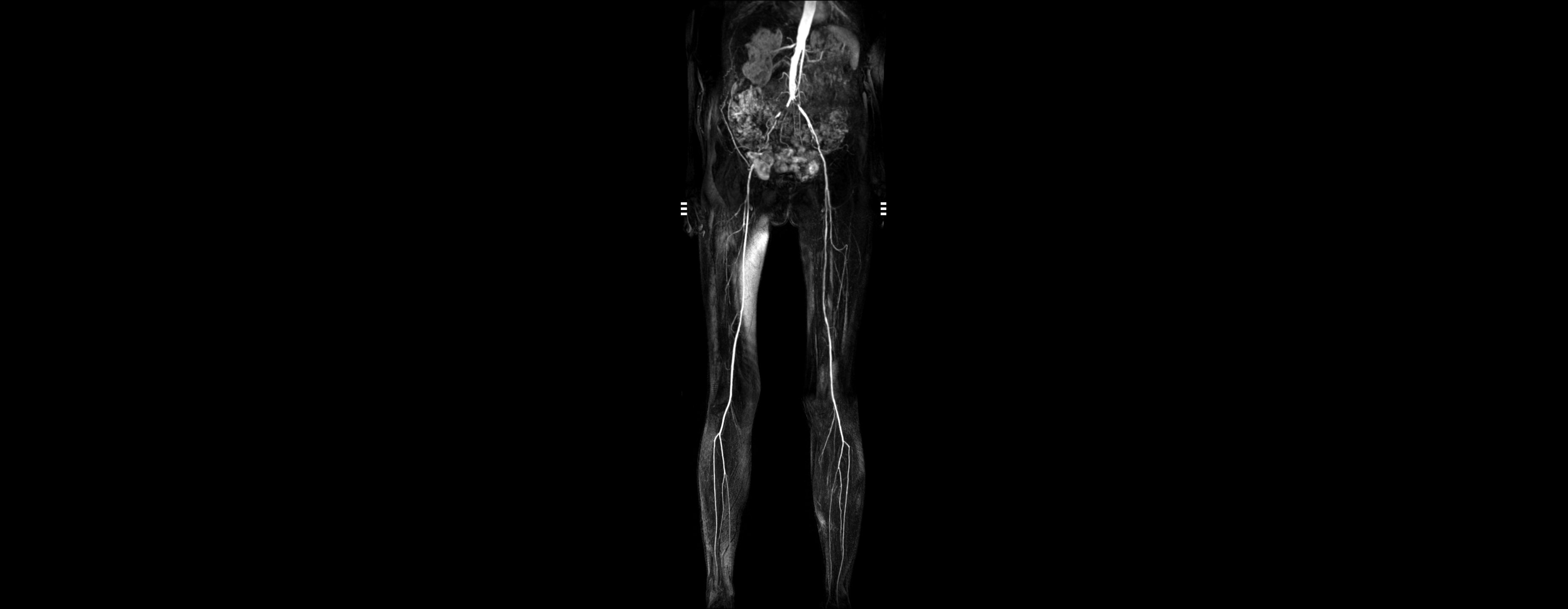 MR Angiographie | Röntgenpraxis im Tesdorpfhaus