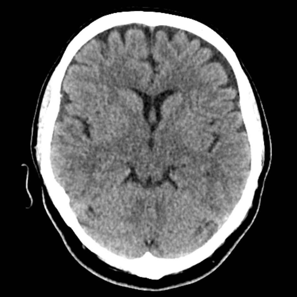 CT Kopf | Röntgenpraxis im Tesdorpfhaus
