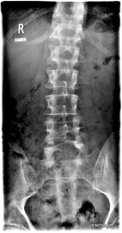 MRT Kopf | Röntgenpraxis im Tesdorpfhaus